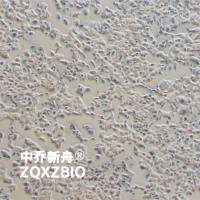 MHCC97-L人肝癌细胞（低转）