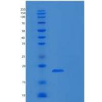 人核糖体蛋白S19(RPS19)重组蛋白