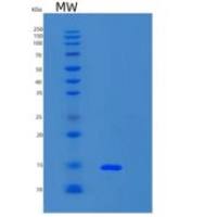 人S100钙结合蛋白A3(S100A3)重组蛋白