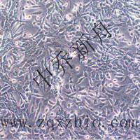 NCI-H446 [H446]人小细胞肺癌细胞