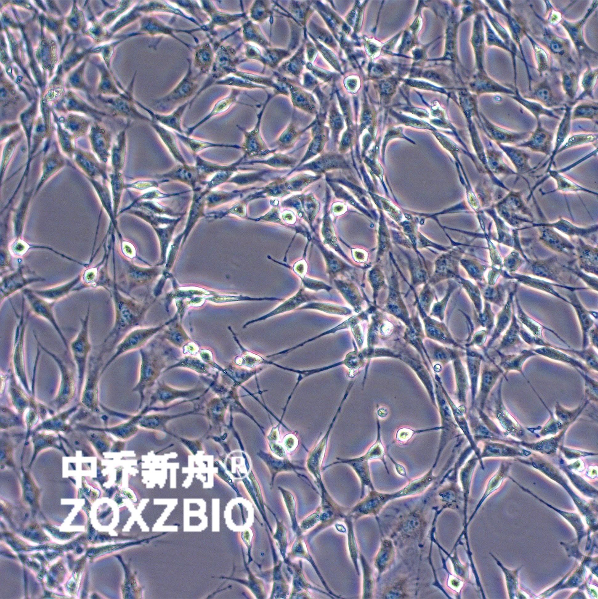 NIH/3T3小鼠胚胎成纤维细胞