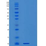 小鼠S100钙结合蛋白B(S100B)重组蛋白