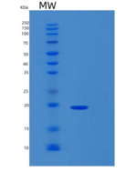 人组蛋白去乙酰化酶复合物亚单位SAP18(SAP18)重组蛋
