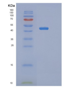 小鼠丝氨酸蛋白酶抑制剂A9(SERPINA9)重组蛋白