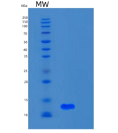 人S100钙结合蛋白A5(S100A5)重组蛋白