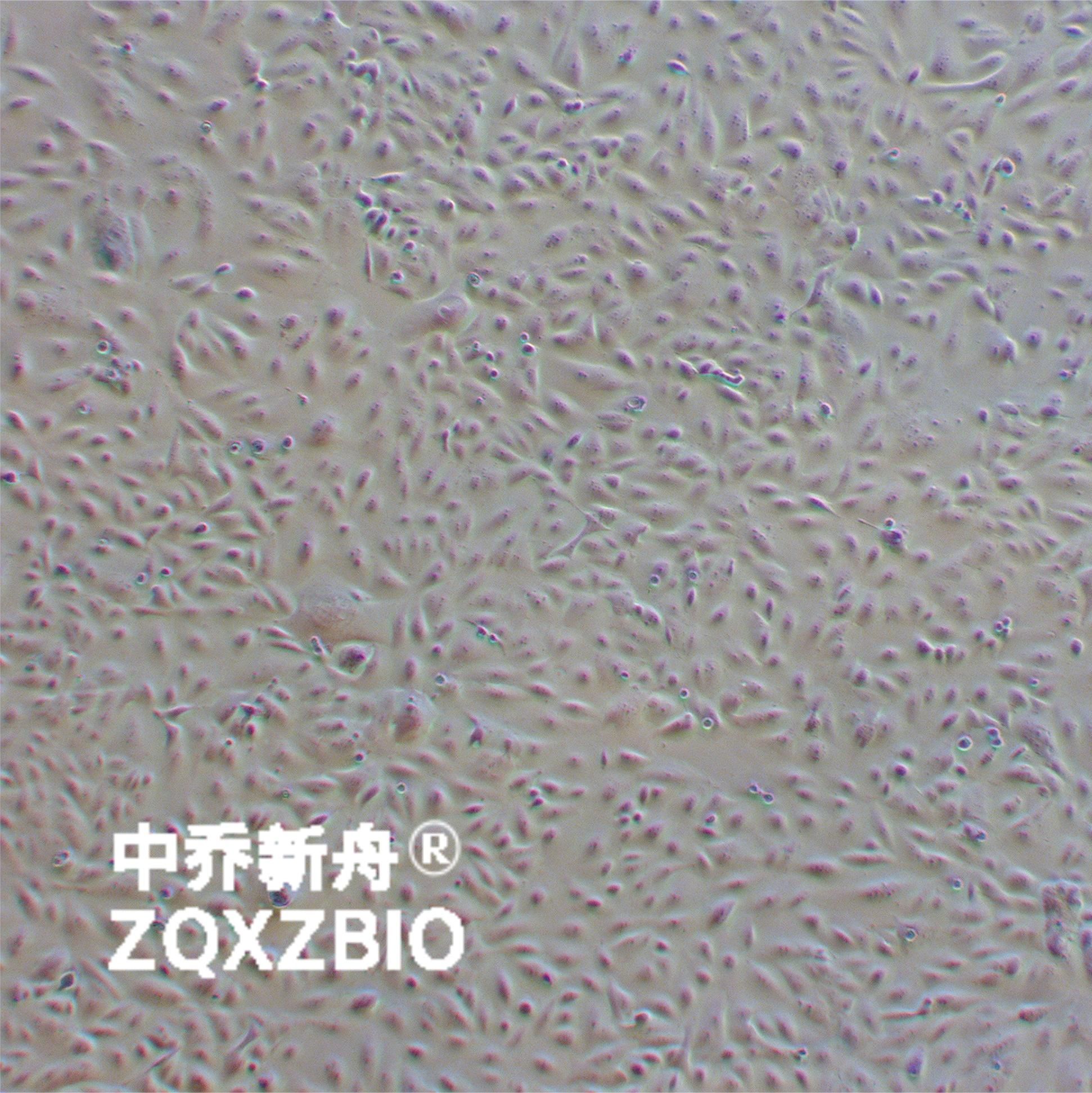 SW480 [SW-480]人结肠腺癌细胞