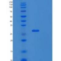 人核糖体蛋白S3(RPS3)重组蛋白