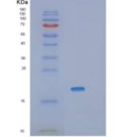 人SFTPD重组蛋白