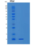 小鼠S100钙结合蛋白B(S100B)重组蛋白