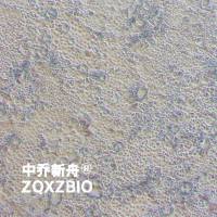 Caco-2人结肠腺癌细胞