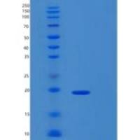 人组蛋白去乙酰化酶复合物亚单位SAP18(SAP18)重组蛋白