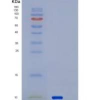 人SERF2重组蛋白