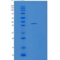 人SEC13重组蛋白