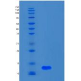 人S100钙结合蛋白A5(S100A5)重组蛋白