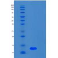 人S100钙结合蛋白A5(S100A5)重组蛋白
