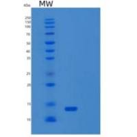 人S100钙结合蛋白Z(S100Z)重组蛋白