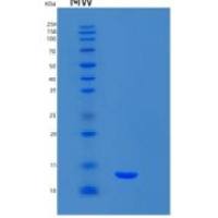 小鼠S100钙结合蛋白A5(S100A5)重组蛋白