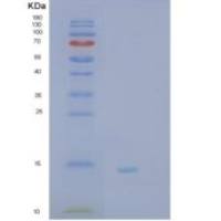 人SH3BGRL2重组蛋白