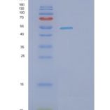 人SHC-转化蛋白1(SHC1)重组蛋白