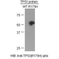 TP53(R175H) Polyclonal Antibody