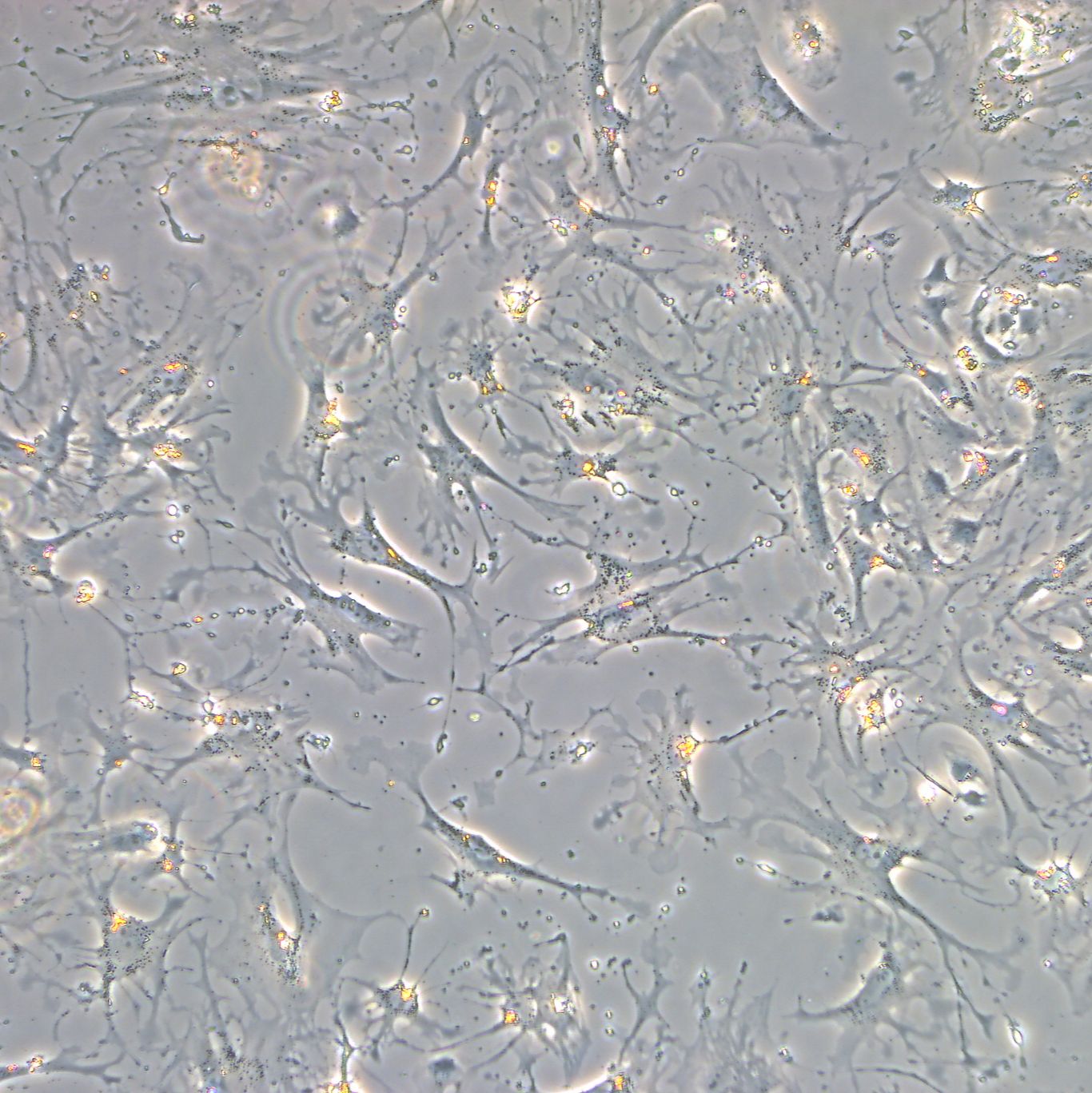 SW579细胞、人甲状腺鳞癌细胞  