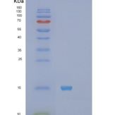 人S100钙结合蛋白A11(S100A11)重组蛋白