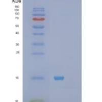 人S100钙结合蛋白A11(S100A11)重组蛋白