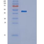 人鳞状细胞癌抗原1(SERPINB3)重组蛋白