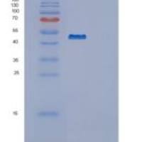 人鳞状细胞癌抗原1(SERPINB3)重组蛋白