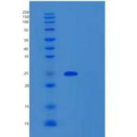 人SAR1B重组蛋白