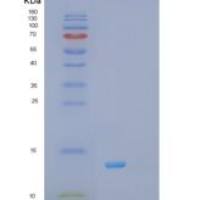 人维甲酸X受体α(RXRa)重组蛋白