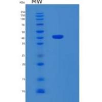 人SAMSN1重组蛋白