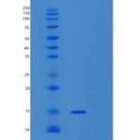 人血清淀粉样蛋白A4(SAA4)重组蛋白