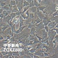 Hep 3B2.1-7人肝癌细胞