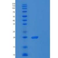 人核糖体蛋白S18(RPS18)重组蛋白