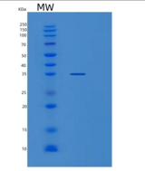 人SDCBP重组蛋白