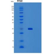 人SENP8重组蛋白