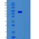 人鳞状细胞癌抗原2(SERPINB8)重组蛋白