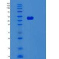 人鳞状细胞癌抗原2(SERPINB8)重组蛋白