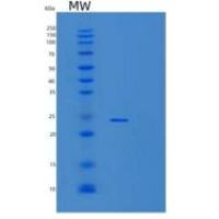 人SIAH1重组蛋白