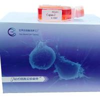 Pfeiffer | Pfeiffer细胞 | Pfeiffer细胞 | 人弥漫