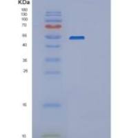 人鳞状细胞癌抗原2(SERPINB4)重组蛋白