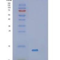 人血清淀粉样A（Serum Amyloid A）重组蛋白