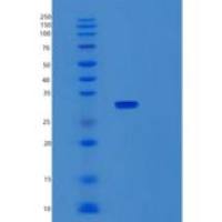 人乌贼墨还原酶(Sepiapterin reductase)重组蛋白