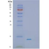 人S100钙结合蛋白A10(S100A10)重组蛋白