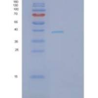人分泌型卷曲相关蛋白4(SFRP4)重组蛋白
