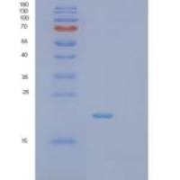 人SCO细胞色素氧化酶缺陷同源物1(SCO1)重组蛋白