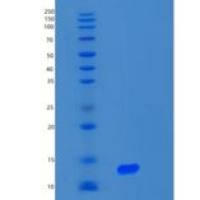 人S100钙结合蛋白A2(S100A2)重组蛋白