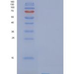 人SHFM1重组蛋白