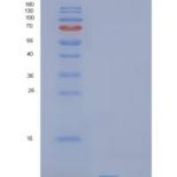 人SHFM1重组蛋白
